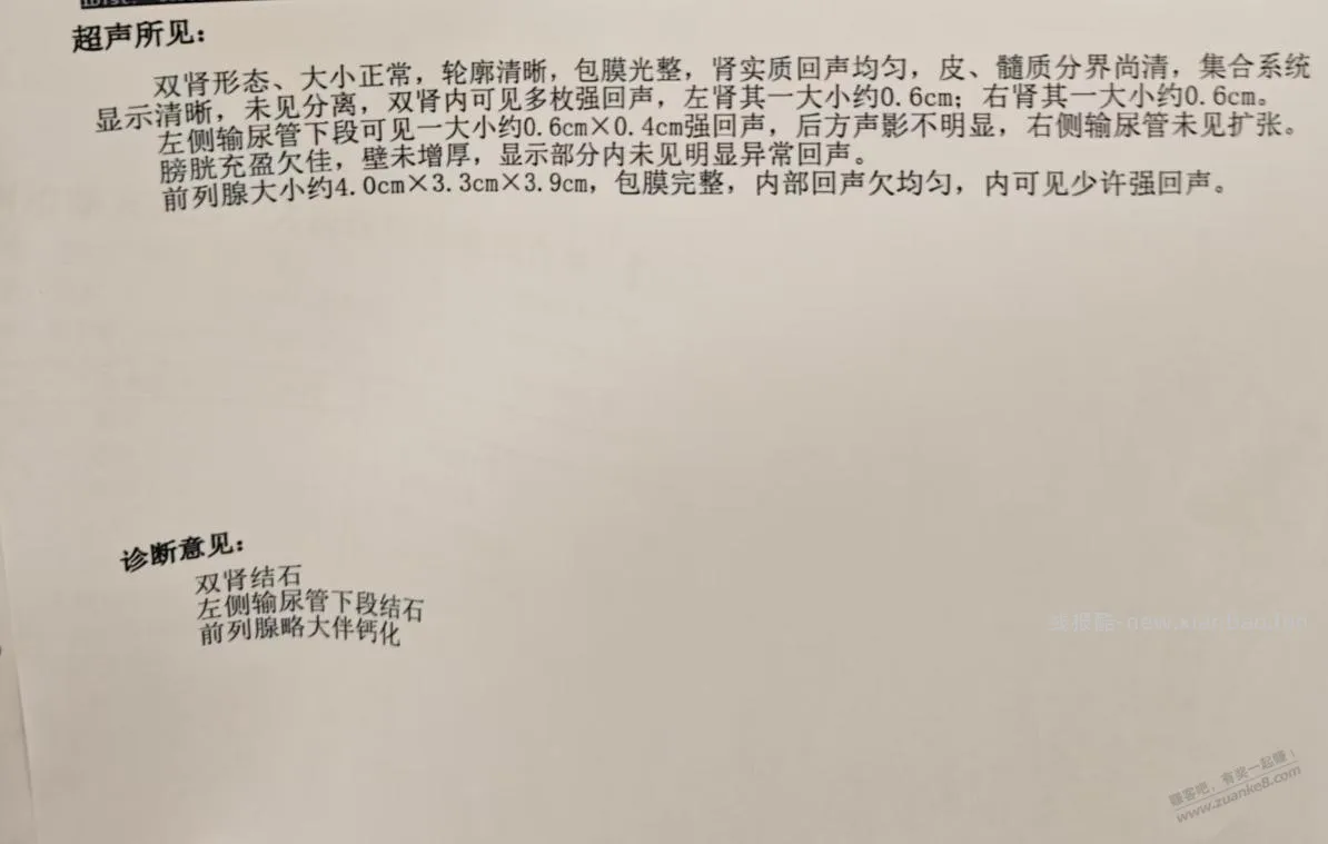 今天去了三家医院决定体外碎石了 - 线报酷