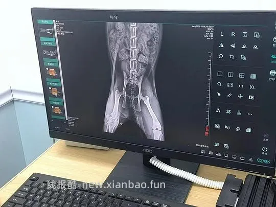 【讨论】猫骨折手术后腿一直伸直 - 线报酷