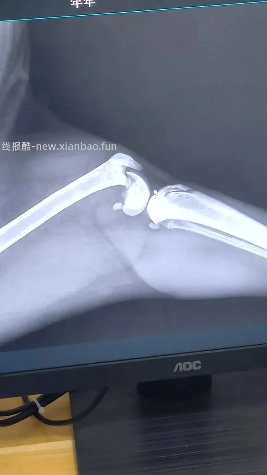 【讨论】猫骨折手术后腿一直伸直 - 线报酷